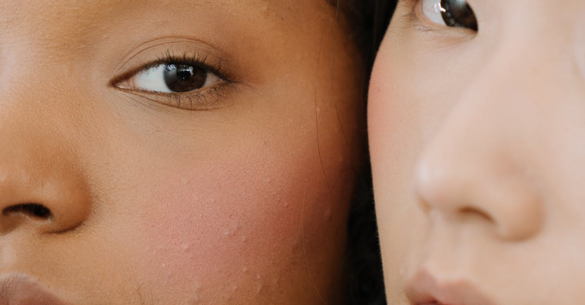 Essential Aftercare for Optimal Laser Treatment Results