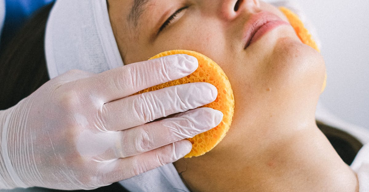 How Chemical Peels Can Minimize the Appearance of Fine Lines