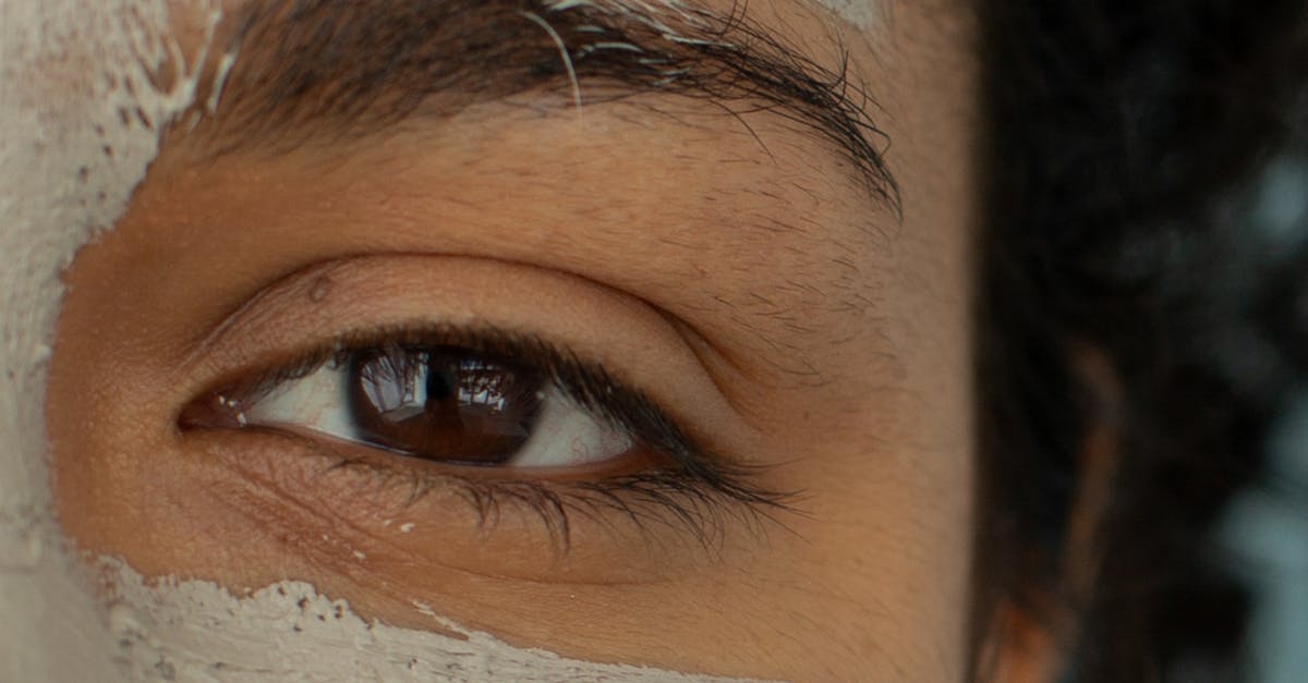Laser Treatments for Uneven Pigmentation: What You Need to Know