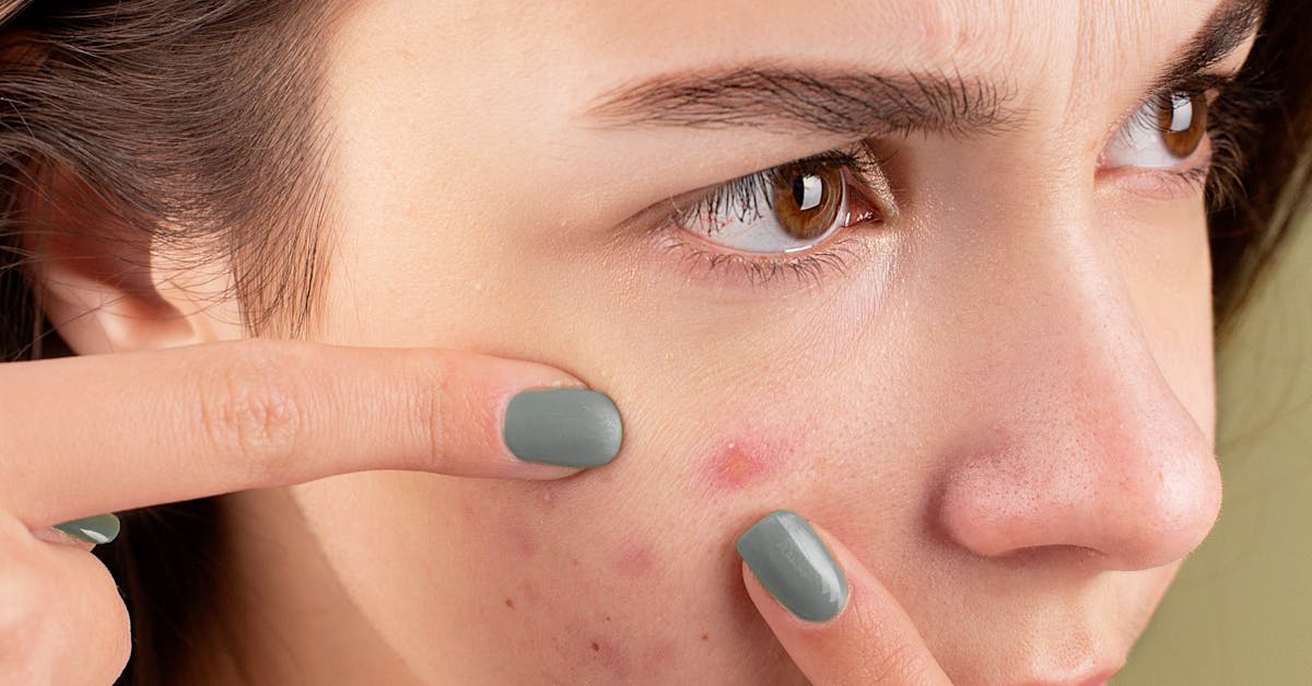 Short-Term and Long-Term Benefits of Microdermabrasion Explained